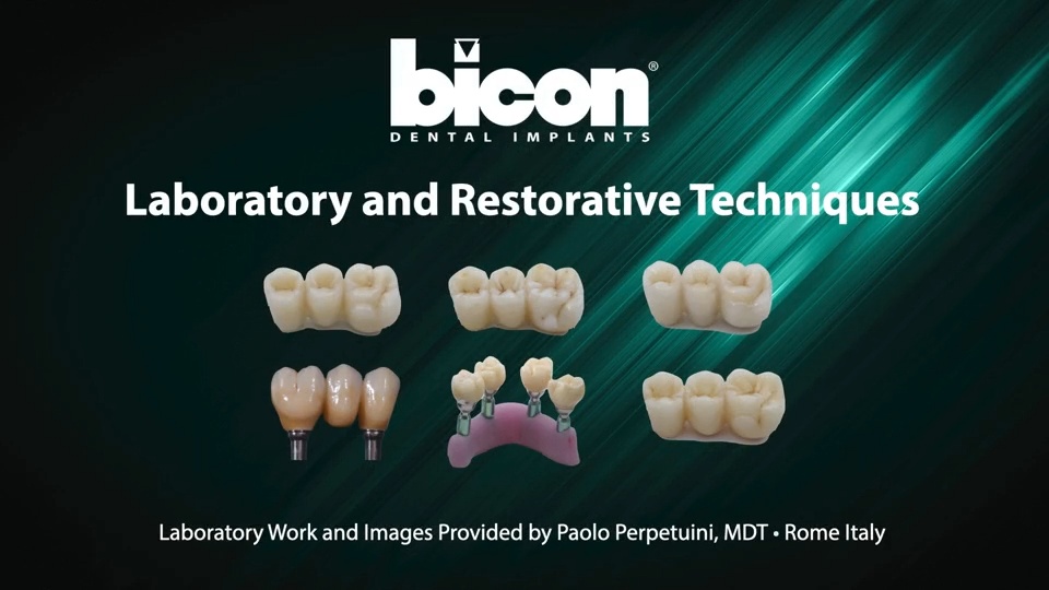 Bicon Scannable Temporary Abutments Provide for Crown Fabrication While Implant is Integrating